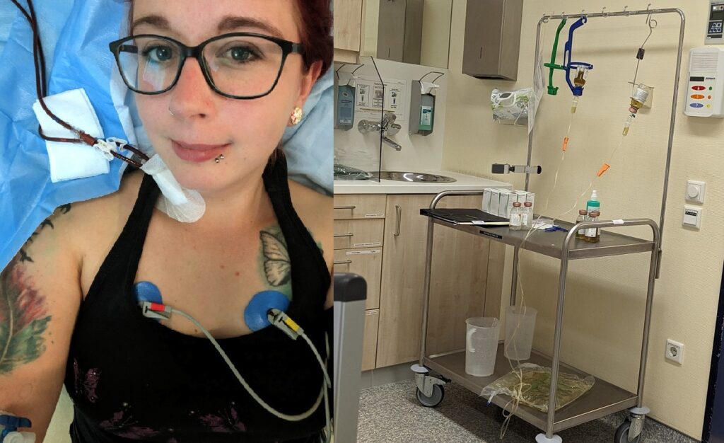 Junge Frau mit Shaldon-Katheter in Hals erhält Plasmapherese-Behandlung. Trotz der Therapie strahlt sie Zuversicht und Lebensfreude aus.