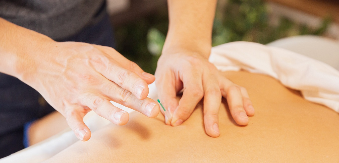 Akupunktur als alternative Therapie bei Multipler Sklerose