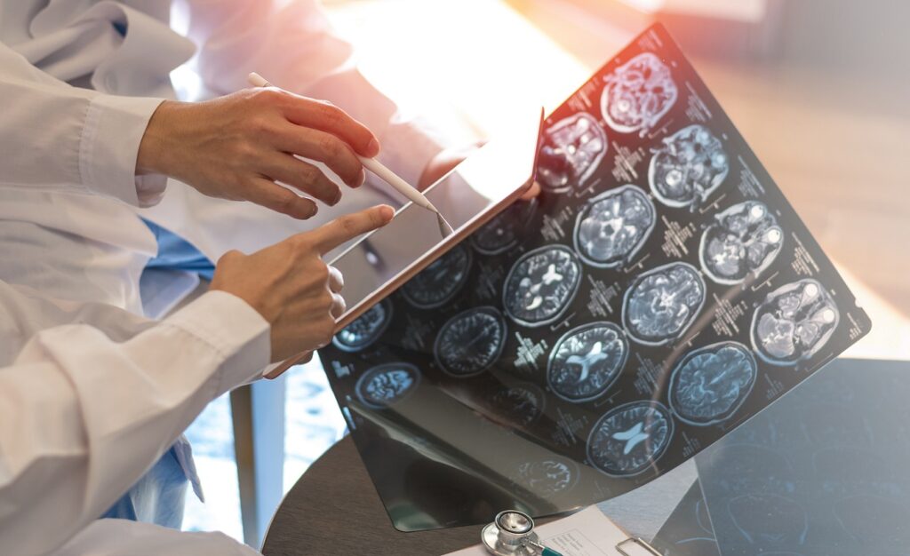 Zwei Ärzte in weißen Kitteln analysieren MRT-Scans und besprechen mögliche MS-Schübe.